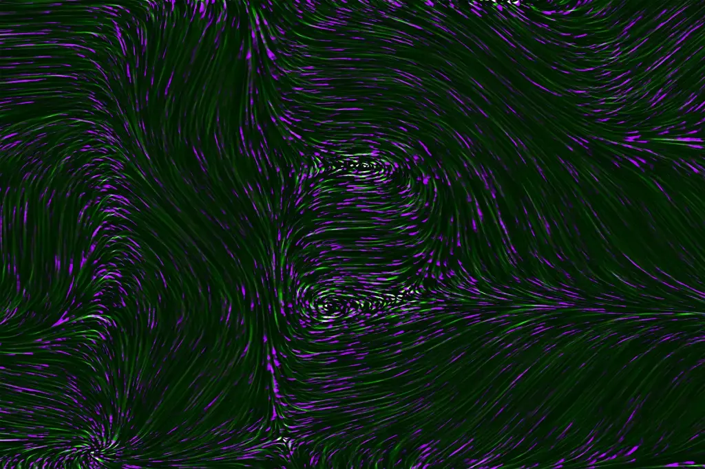 Human Skeletal Muscle Myoblasts   -1 vial