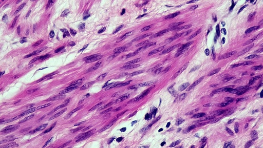 [ABC-TC3693] Human Mammary Epithelial Cells, Male   -1 vial